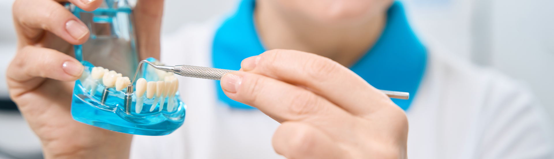 El mejor lugar para implantes dentales en Quito¿Cuál es el mejor lugar para implantes dentales en Quito?banner