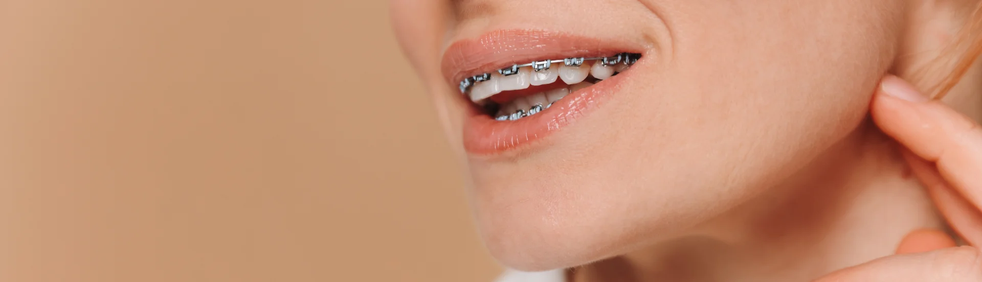 Ortodoncia en Quito y estética en clínica dental en QuitoPrecios y Tipos de Ortodoncia en Quitobanner