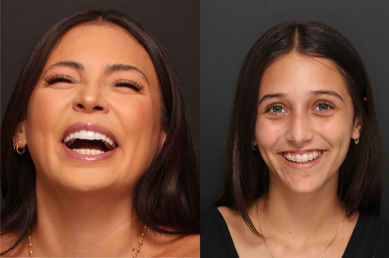 Imagen para Guía de estética dental en Ecuador | Blog Depau Dental