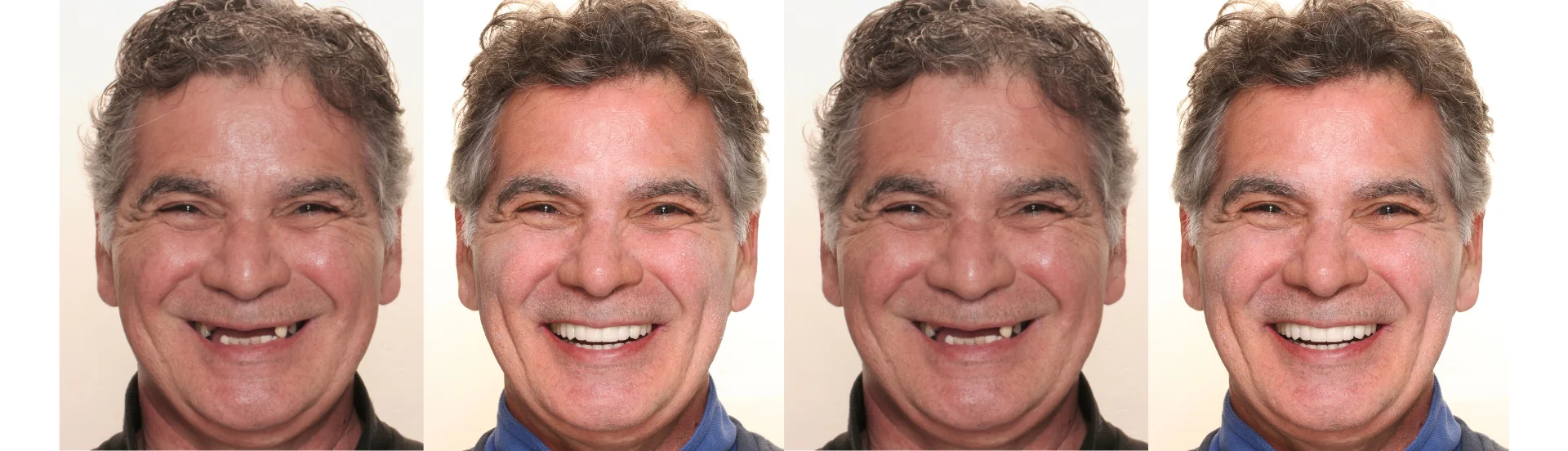 Paciente en consulta de implantología evaluando la colocación de implantes dentales en Quito con odontólogos especialistas.¿Cuándo ponerte implantes dentales en Quito? | Blogbanner