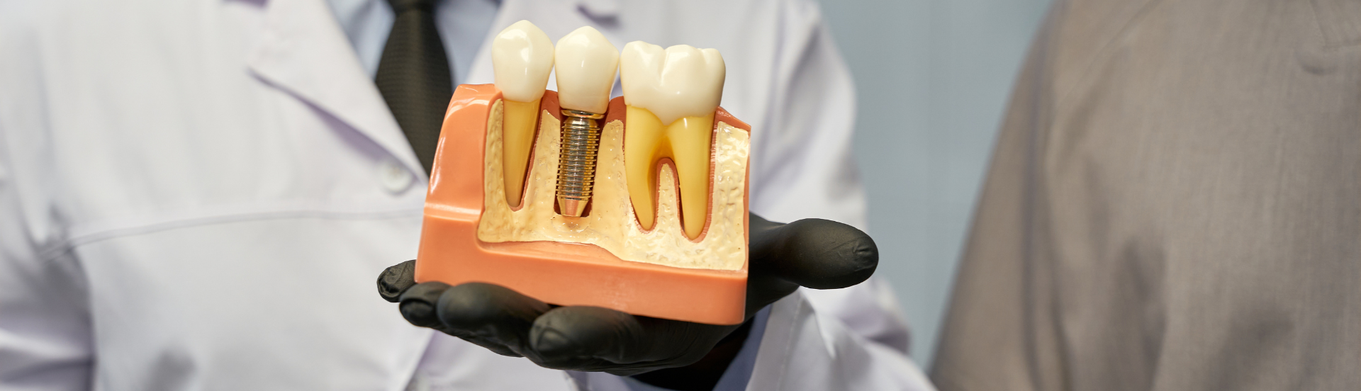 Clínicas especializadas en implantes dentales en QuitoClínicas especializadas en implantes dentales en Quitobanner