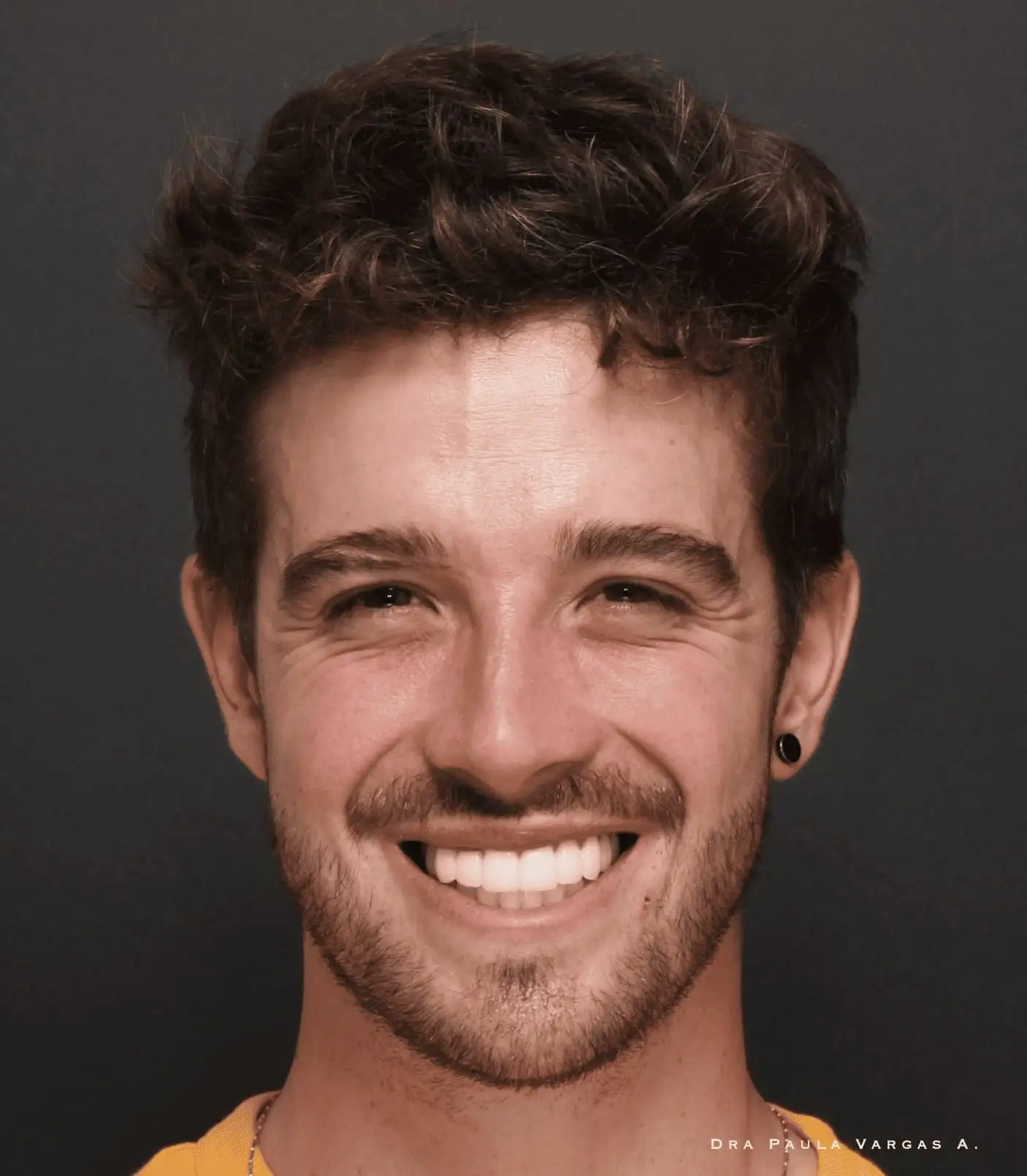 Antes